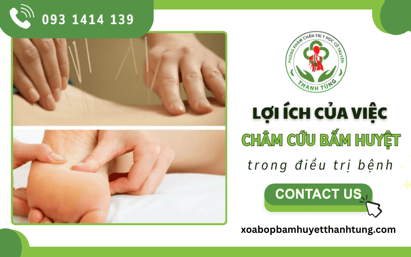 Lợi ích của việc châm cứu bấm huyệt trong điều trị bệnh